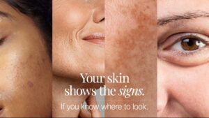 Signs That Your Skin Is Losing Collagen